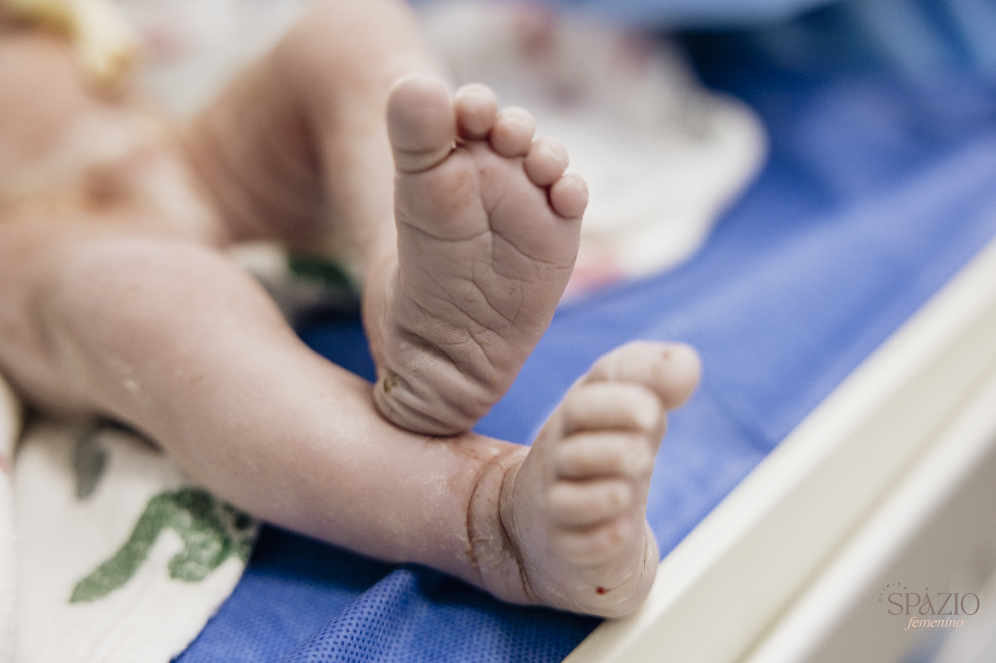 Atención personalizada en cesárea